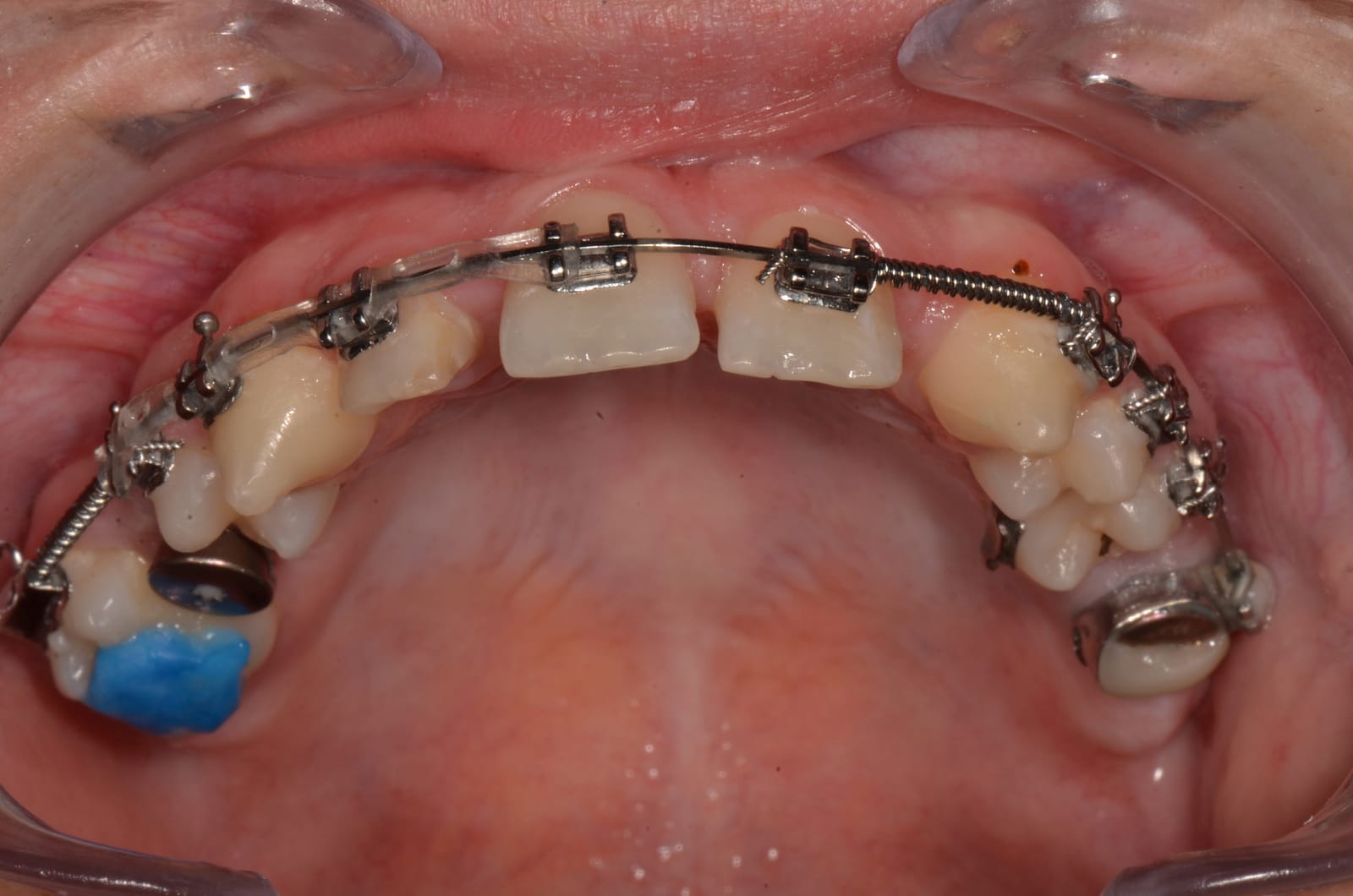 7.ortho_ 7.ortho_